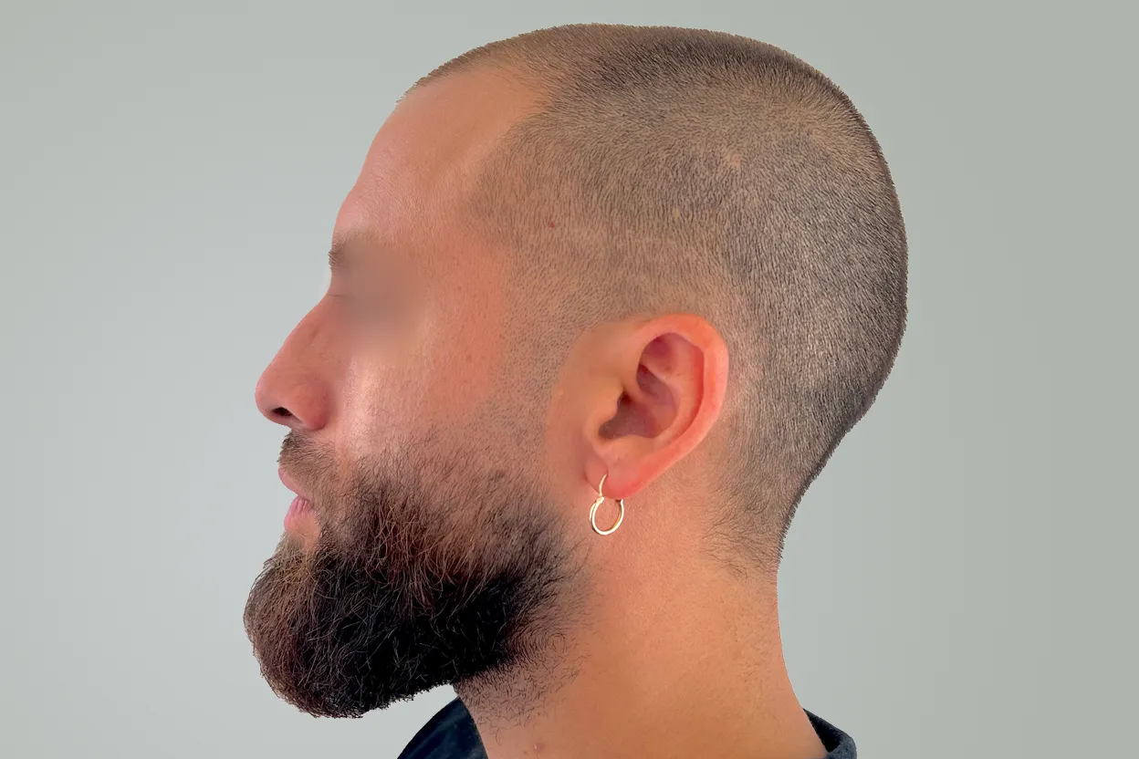 rinom_ants_fin copia